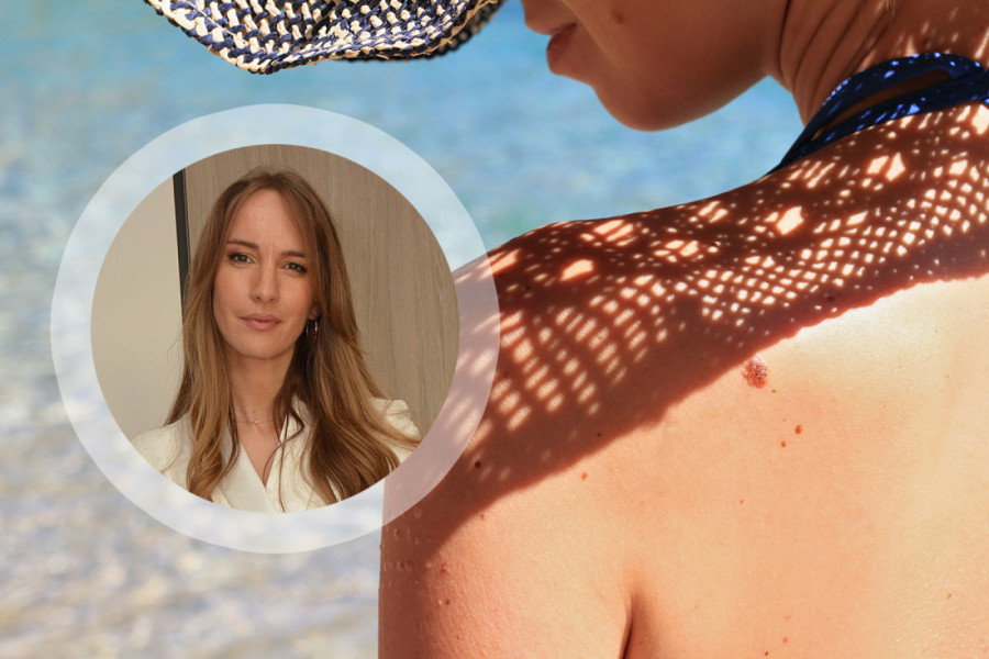 Dermatolog dr Bojana Novović upozorava: Ova greška sa suncem uništava kožu već u proleće – većina ljudi je pravi svakog dana
