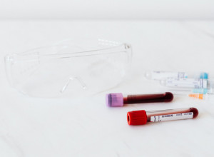 HRANA PROTIV KANDIDE: Ne želite da dozvolite da se ova gljivica namnoži!