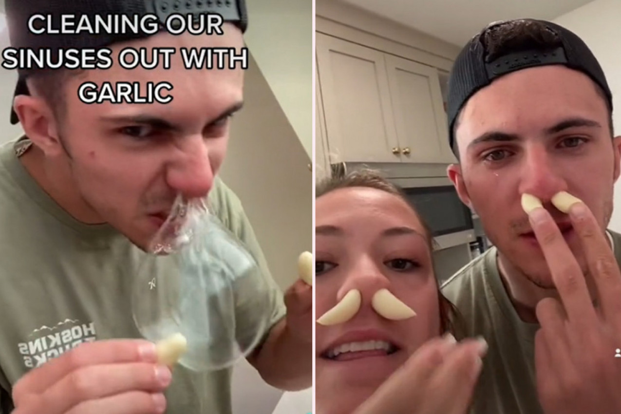 DA LI JE ZDRAVO GURATI BELI LUK U NOS? Lekari komentarišu novi ludi tiktok trend!