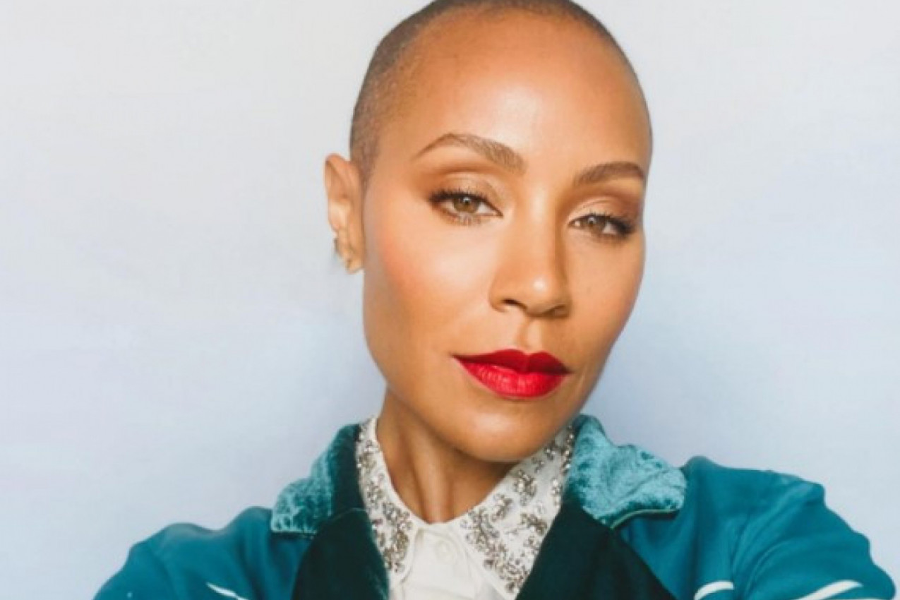 ĆELAVA SAM, PA ŠTA? Džejda Smit otkriva kako se bori sa gubitkom kose