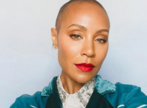 ĆELAVA SAM, PA ŠTA? Džejda Smit otkriva kako se bori sa gubitkom kose