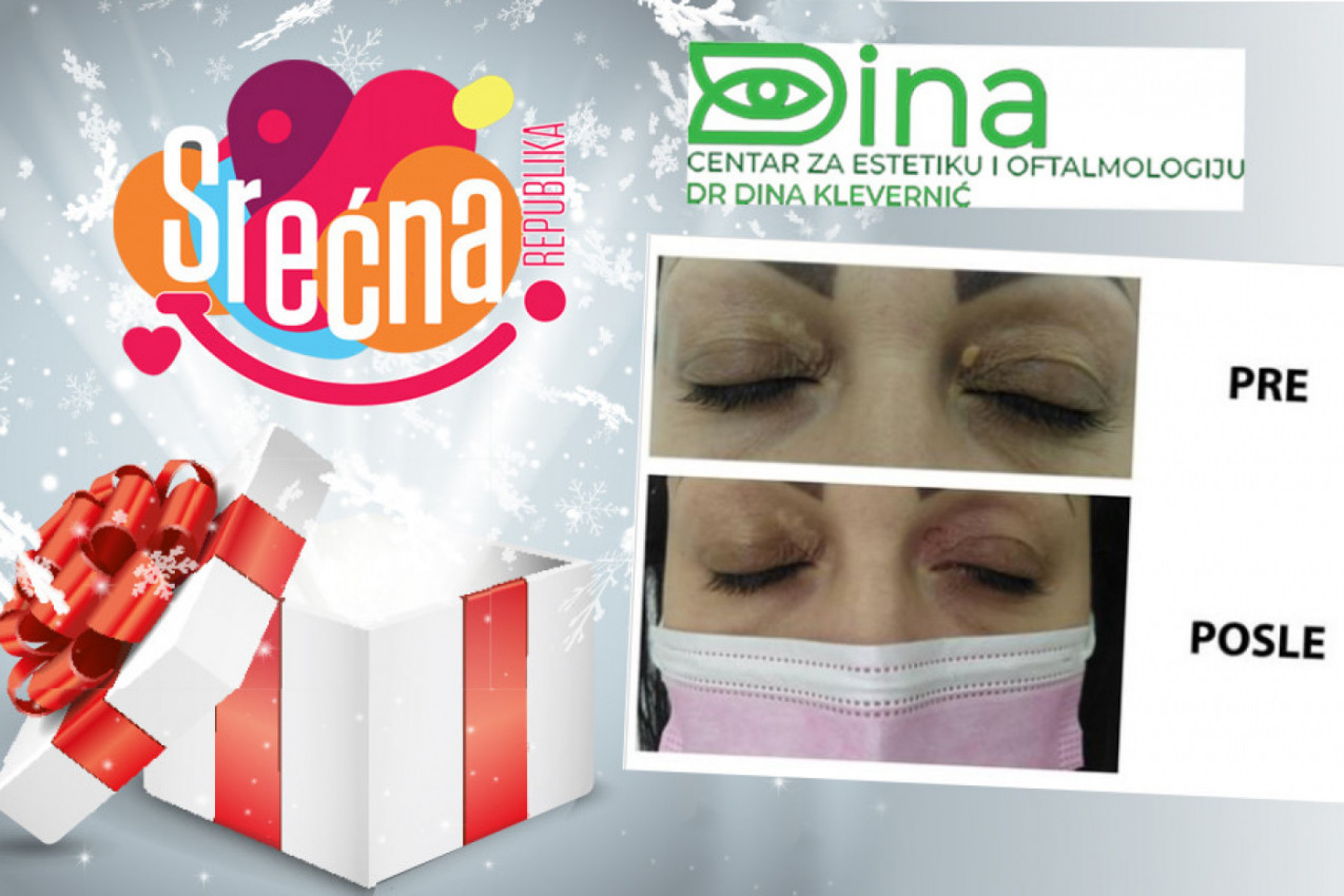 POKLANJAMO SAVRŠEN POGLED: Srećna Republika Vas vodi na uklanjanje masnih naslaga sa očiju