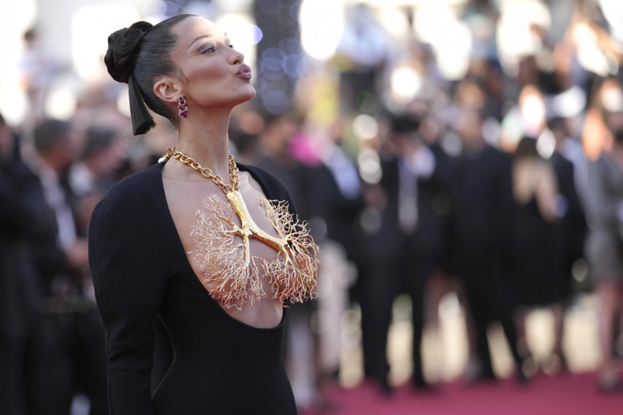 JEDNA OD NAJLEPŠIH ŽENA SVETA SE IZOPERISALA SA SAMO 14 GODINA! Evo šta je uradila i sada se gorko kaje