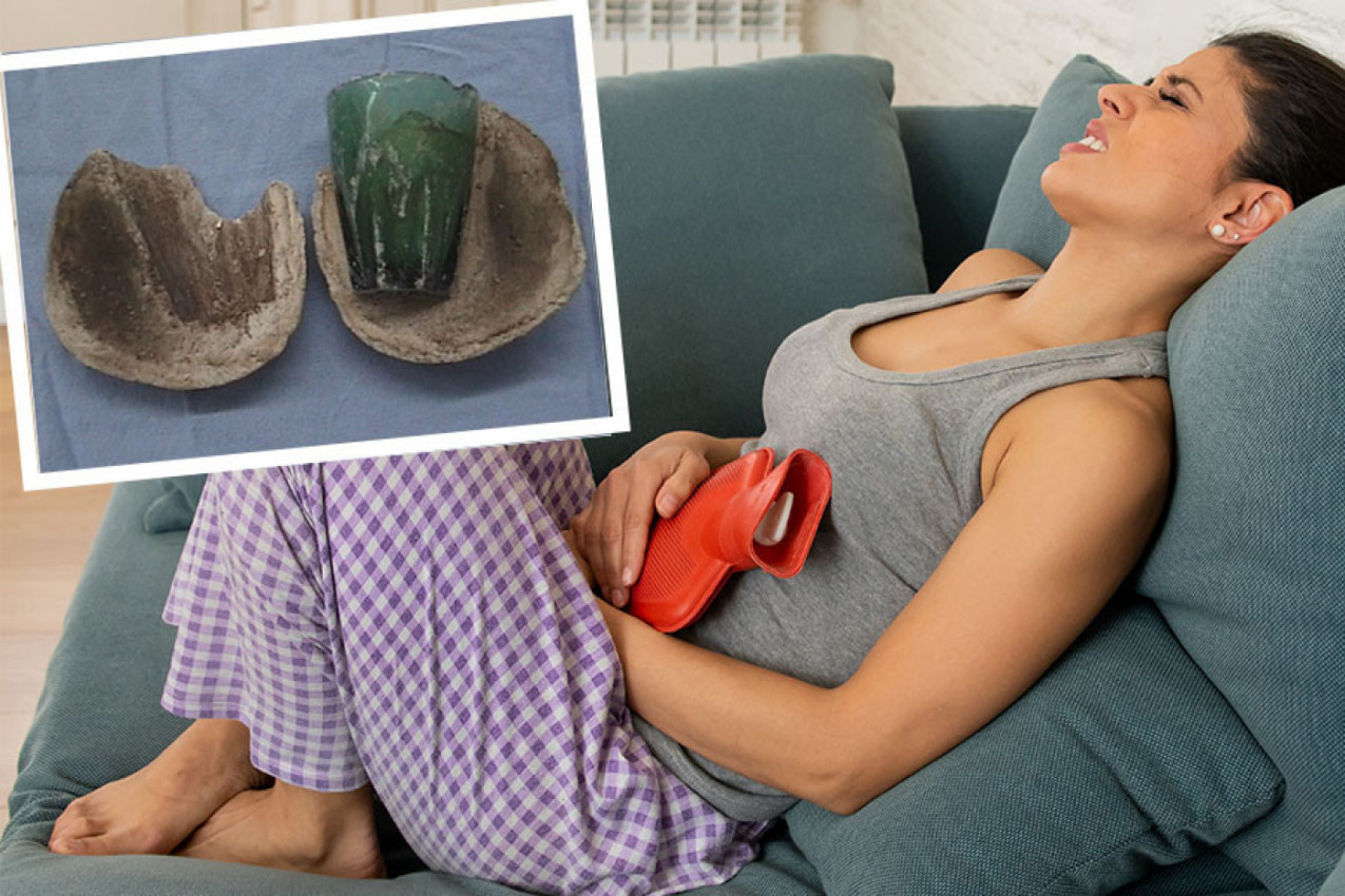 IZ BEŠIKE JOJ IZVADILI ČAŠU! Ove fotografije će vas zaprepastiti, a posebno razlog otkud predmet na tom mestu!