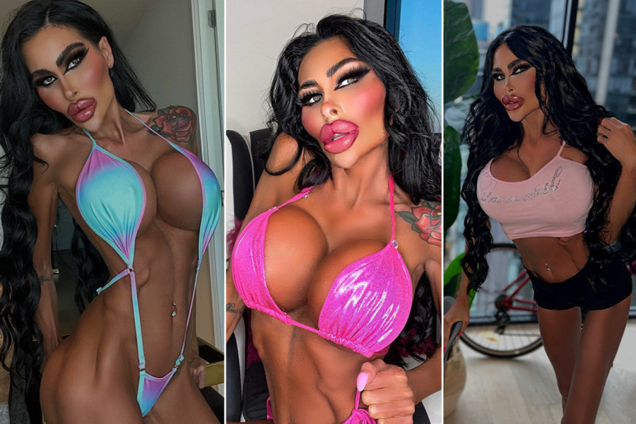 KRALJICA PLASTIKE PUKLA 200.000 DOLARA NA OPERACIJE! Pojavila se u javnosti i šokirala ljude!