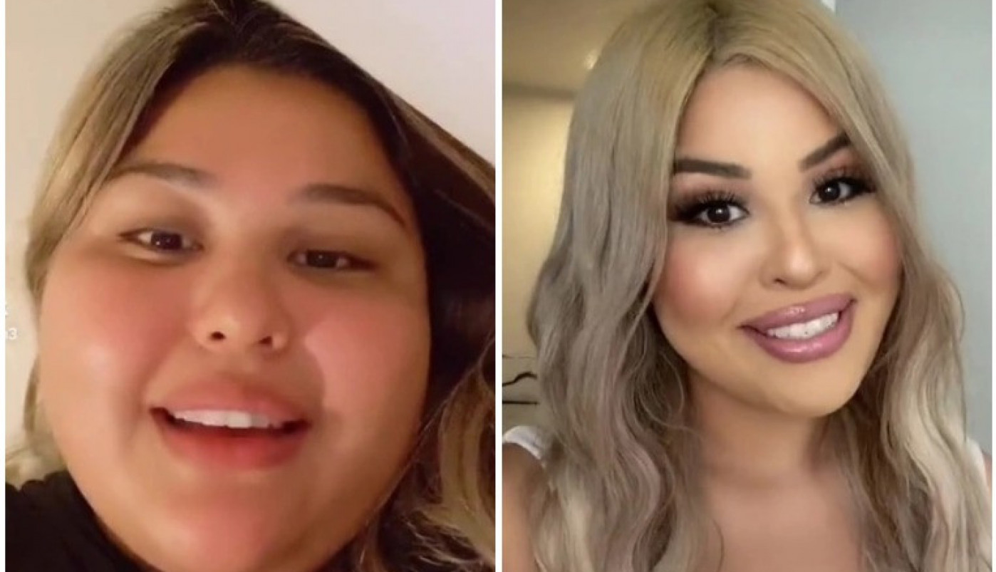 UZ SVE DIJETE NISAM MOGLA DA SMRŠAM! A onda su lekari iz mene izvadili nešto što me je uništavalo!