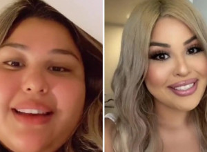 UZ SVE DIJETE NISAM MOGLA DA SMRŠAM! A onda su lekari iz mene izvadili nešto što me je uništavalo!