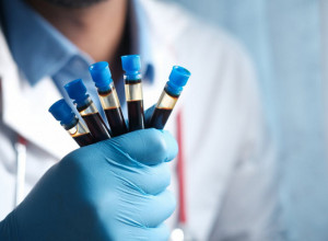 KARAKTER PREMA KRVNIM GRUPAMA: Da li ste organizator ili efikasni radnik?