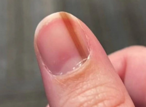 MISLILA SAM DA JE BELEG NA NOKTU SUPER, DOK NISAM OTKRILA ŠTA JE! Istina me je potpuno porazila!