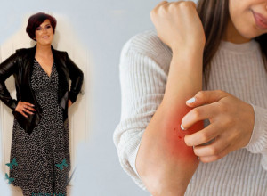 TRPELA SAM NESNOSAN SVRAB, A LEKARI NISU MARILI! Kada su desni počele da mi krvare, otkrila sam strašnu istinu!