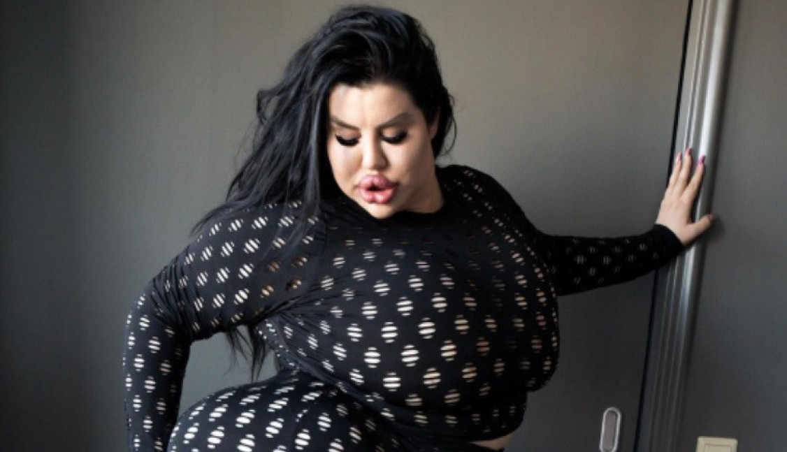 SRPKINJA IMA NAJVEĆU ZADNJICU NA SVETU! Operacije je platila više od 100.000 evra,  a novom kombinacijom je šokirala! (FOTO, VIDEO)