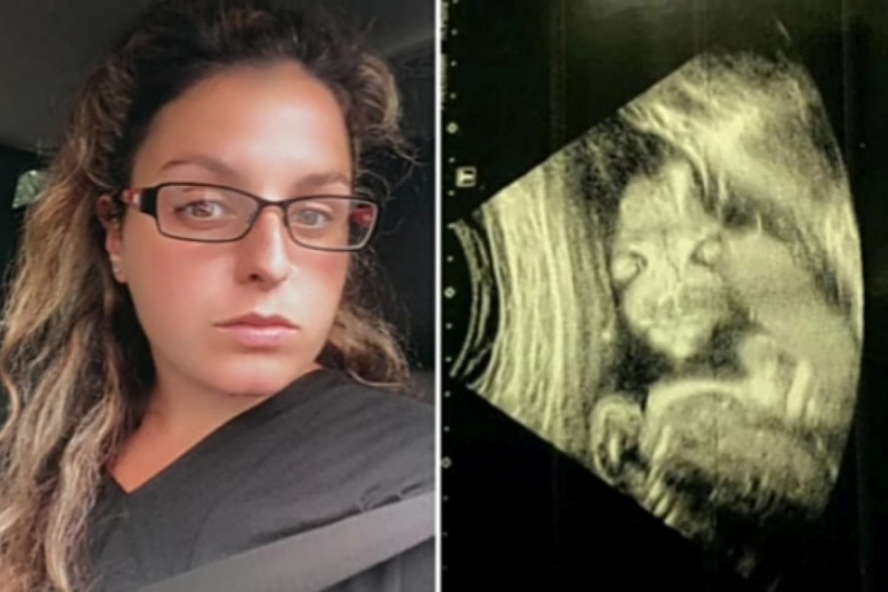 PRESTRAVIO ME JE SNIMAK MOJE BEBE U STOMAKU! Nakon ovoga plašila sam se porođaja više od svega!