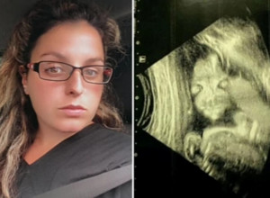 PRESTRAVIO ME JE SNIMAK MOJE BEBE U STOMAKU! Nakon ovoga plašila sam se porođaja više od svega!