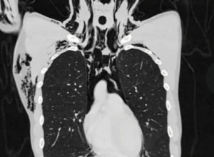 MASTURBIRAO, PA ZAVRŠIO NA INTENZIVNOJ NEZI! Ono što se dogodilo ovom mladiću zbunilo je i najveće stručnjake!