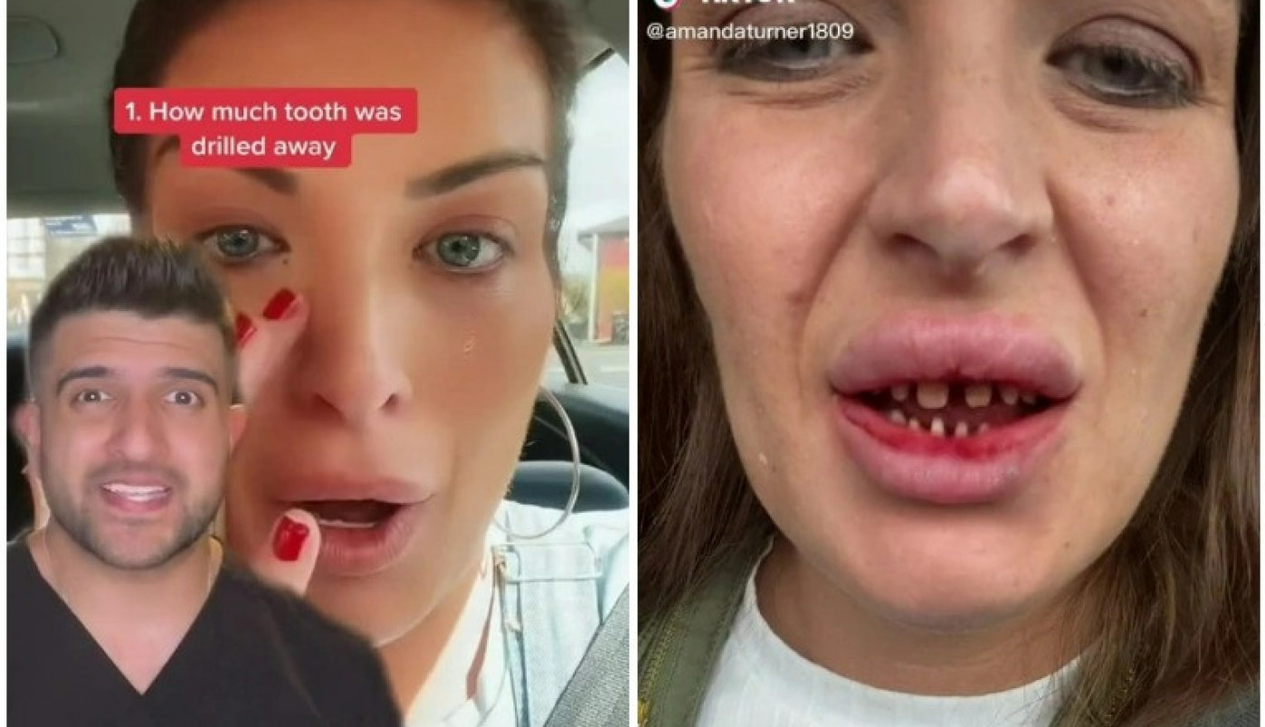 IŠLA SAM U TURSKU PO HOLIVUDSKI OSMEH, A VRATILA SAM SE KAO NAKAZA! Potresna ispovest britanske lepotice!