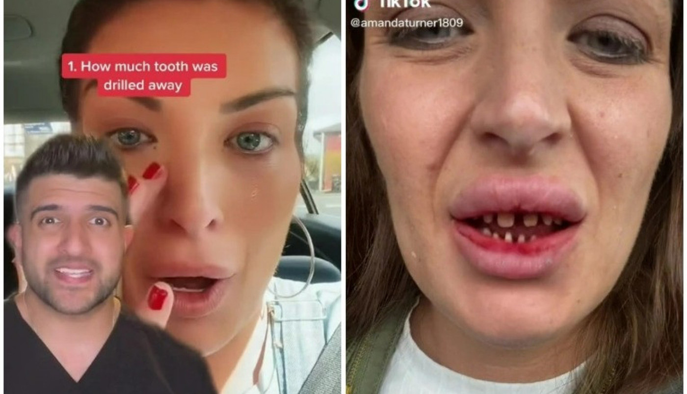 IŠLA SAM U TURSKU PO HOLIVUDSKI OSMEH, A VRATILA SAM SE KAO NAKAZA! Potresna ispovest britanske lepotice!