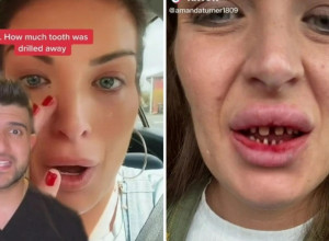 IŠLA SAM U TURSKU PO HOLIVUDSKI OSMEH, A VRATILA SAM SE KAO NAKAZA! Potresna ispovest britanske lepotice!