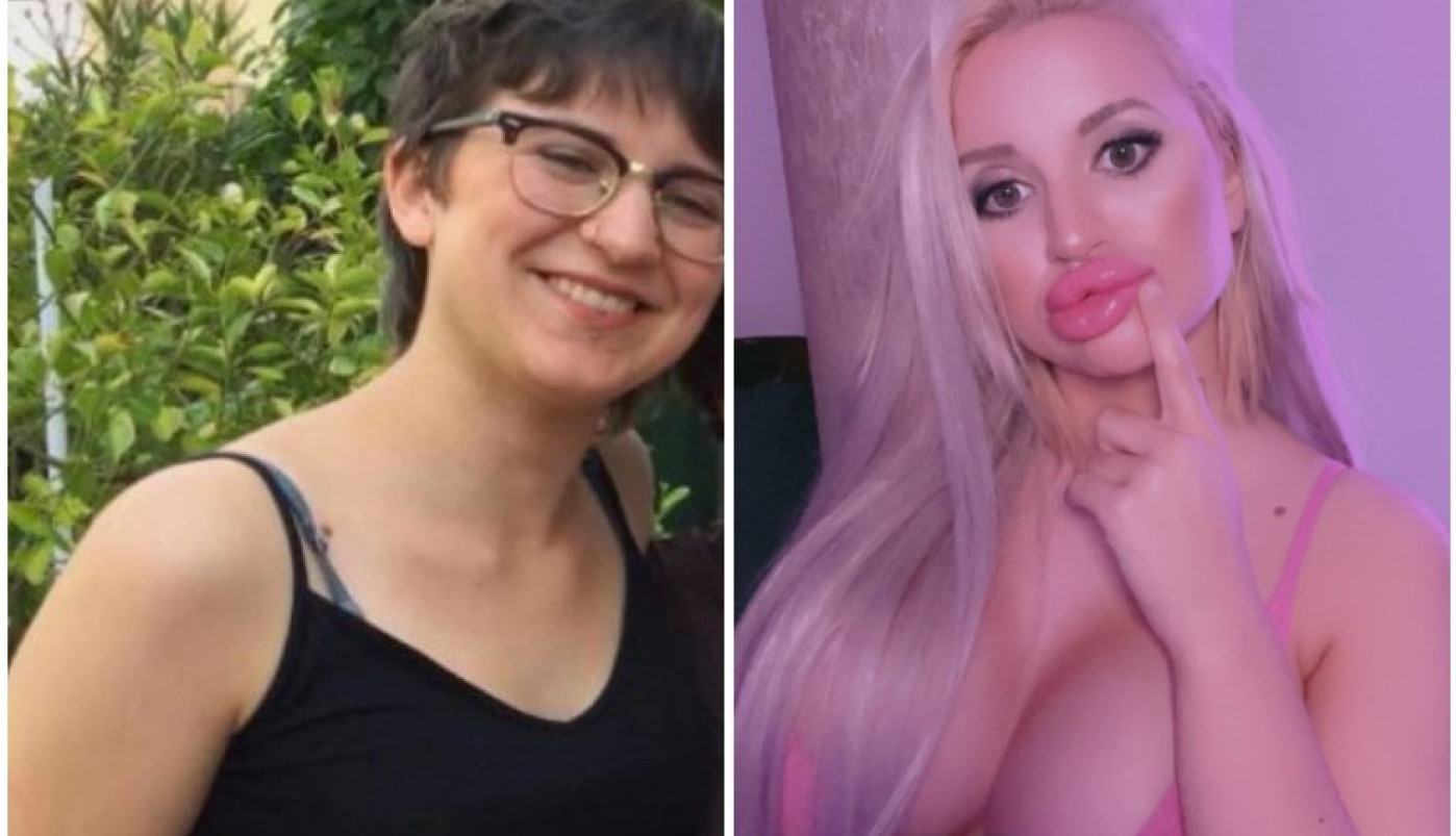 ŠTA MISLITE KOLIKO JE OPERACIJA IMALA OVA ŽENA? Želela je da bude ljudska barbika, a to ju je koštala nečega što NIKAKO nije želela da izgubi (FOTO)