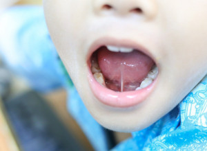 DEČAKU SLATKIŠ PROBUŠIO JEZIK, ZAVRŠIO U HITNOJ! Jezivo upozorenje očajne majke podiglo je svet na noge! (FOTO)