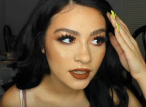 OPASNI TREND ŠIRI SE INTERNETOM, ŠOK-FOTKE ŽENE: Farbom za kosu sam iscrtala pege, ne pokušavajte to!