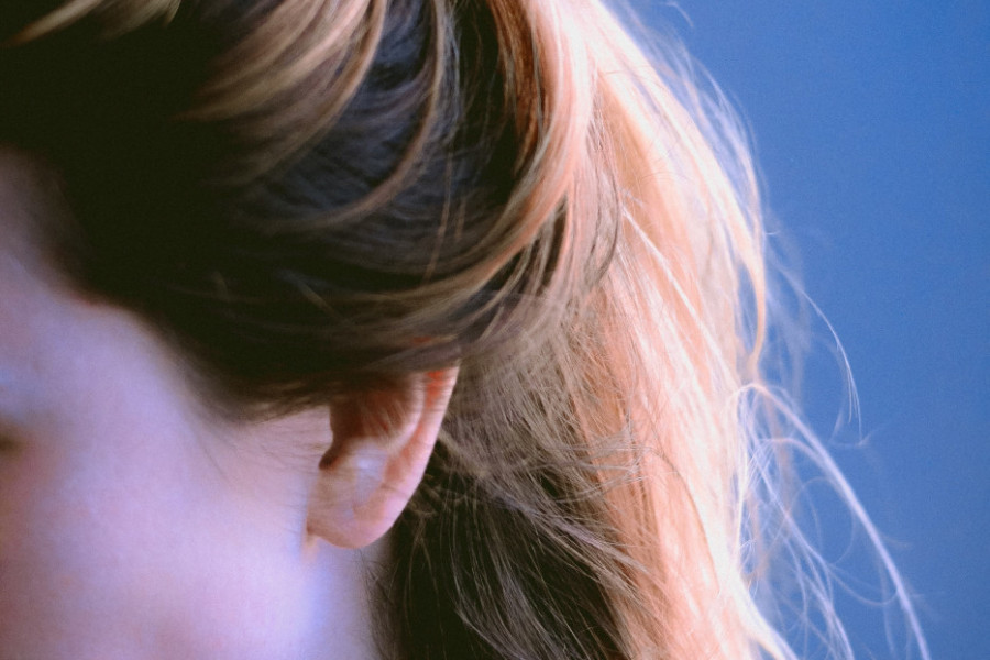 DA LI VAM KOSA NEPRIJATNO MIRIŠE ČAK I POSLE PRANJA? Mnogi koji pate od ovog problema ne znaju šta je uzrok, ni kako da se leče! (FOTO)