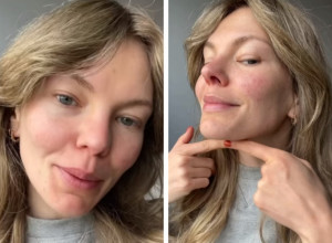 UKLONITE PODBRADAK ZAUVEK: Da li znate šta je joga za lice?