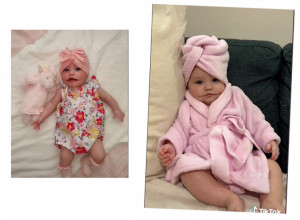 BEBA ROĐENA SA VEČNIM OSMEHOM! Kada su je videli, roditelji su doživeli šok, ali evo šta se zatim dogodilo sa njom! (FOTO)