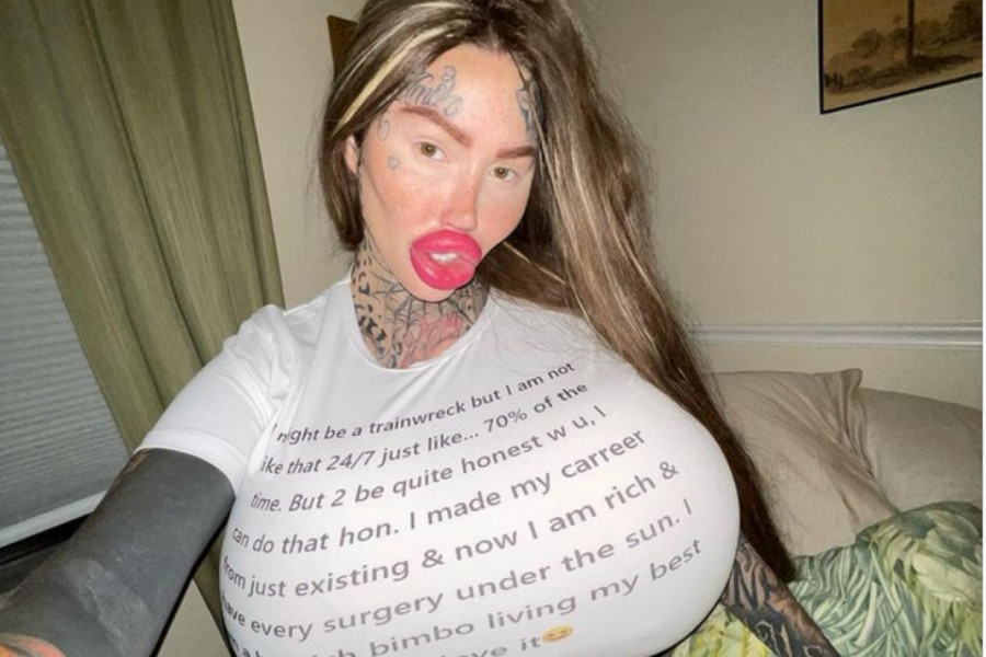 MARIJI JE PUKAO SILIKON U GRUDIMA I NAKON TOGA JE OTIŠLA NA JOŠ JEDNU OPERACIJU: Evo kako sada izgleda, totalna transformacija! (VIDEO)