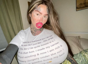 MARIJI JE PUKAO SILIKON U GRUDIMA I NAKON TOGA JE OTIŠLA NA JOŠ JEDNU OPERACIJU: Evo kako sada izgleda, totalna transformacija! (VIDEO)