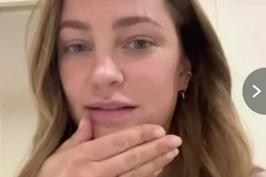 Želela sam novu bradu, a ono što su mi uradili pretvorilo mi je život u pakao! SADA IMAM ĆUREĆI VRAT!