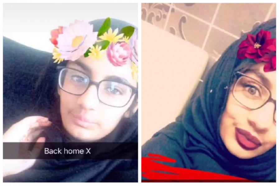 Nanela je ŠAMPON NA KOSU, a onda joj se život promenio iz KORENA: Bila je u komi dva MESECA jer je otišla u KUHINJU i uradila ovo!