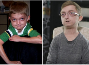 DANAS DEČAK, SUTRA DEDA! Jedini na svetu ima ovu bolest: Stari pet puta brže od bilo koga! (VIDEO)