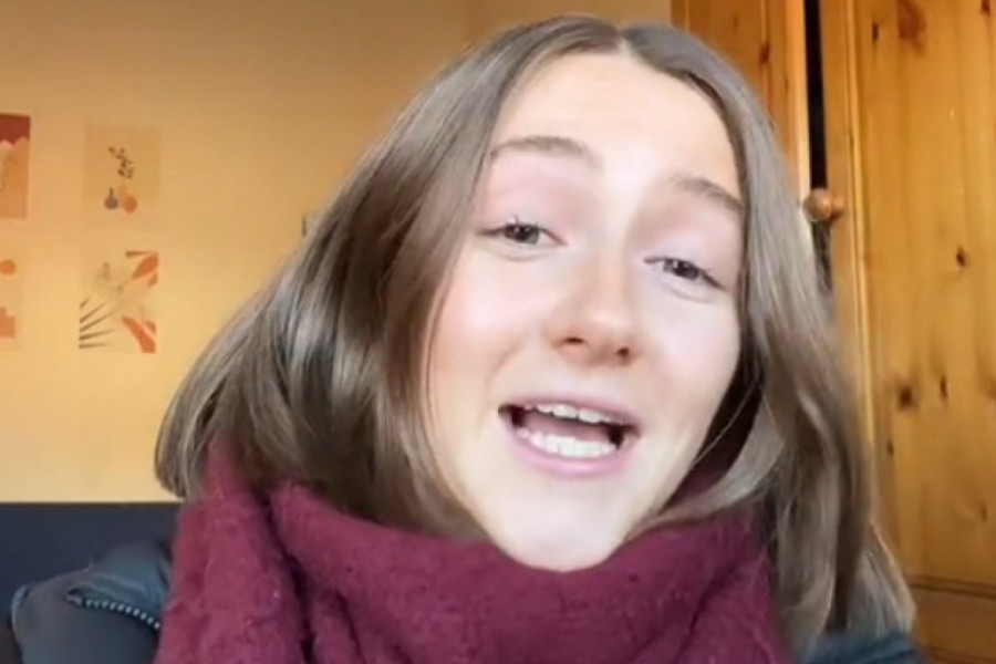 Ovu devojku je zabolelo GRLO,  a nedugo zatim dobila je osip, a dijagnoza joj je LEOPARD KOŽA na koju je ona veoma PONOSNA! (FOTO+VIDEO)