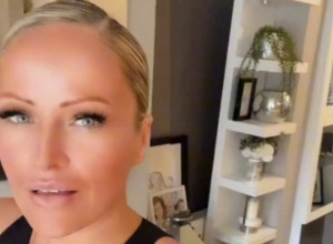 NIJE KORISTILA KREMU ZA SUNČANJE, A SADA JE POKAZALA POSLEDICE! Kada joj vidite glavu šokiraćete se, a tek LICE (FOTO)