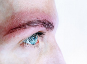 Komadi kože otpadali su mi s obrvama, a onda je počelo gušenje! POTRESNA ISPOVEST, samo je želela da sredi lice, a završila je u HITNOJ! (FOTO, VIDEO)