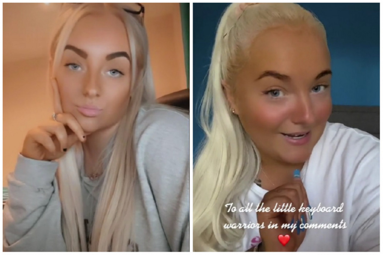 SA 18 MESECI SAM DOBILA MENSTRUACIJU, a sa sedam godina sam imala grudi kao devojka! Šokantna ispovest o izuzetno retkom poremećaju!