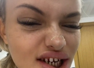 Ispunili su mi želju da KONAČNO DOBIJEM SVOJ TURSKI OSMEH! Ova devojka zaprepastila je svet!