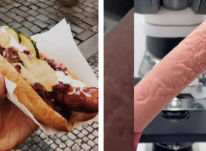 Objavljen šokantan snimak mikroskopskog prikaza viršli! Zbog onog što je zabeleženo zapitaćete se dvaput da li ćete ih ponovo jesti!