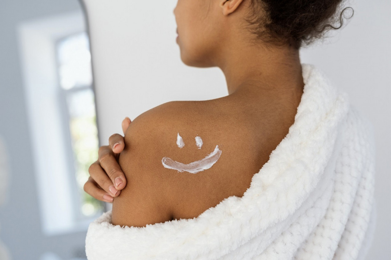 SVI GREŠIMO! Jogurt nije za opekotine od sunca