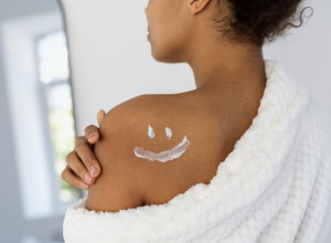 SVI GREŠIMO! Jogurt nije za opekotine od sunca