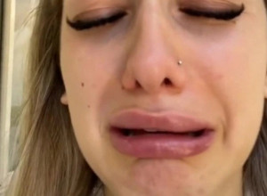 OČAJ ZBOG FILERA U USNAMA! Devojka podelila sa čitavim svetom kako izgleda nakon intervencije: Patka mi nije ravna!