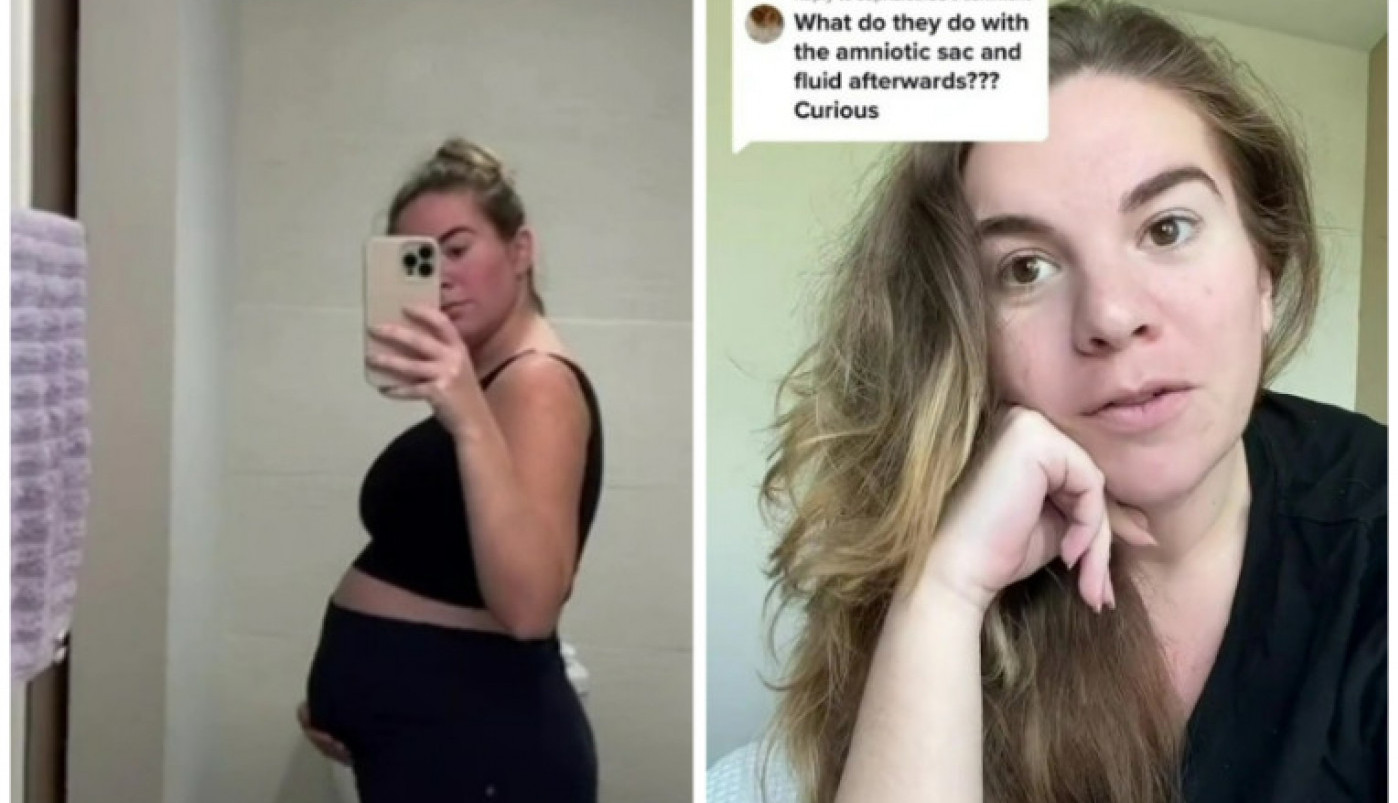 Postaću majka prvi put, ali MOJU BEBU MORAM DA RODIM DVA PUTA! Šokantan slučaj ove mlade mame zaprepastio je svet!