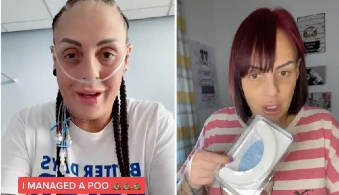 OVA ŽENA MESEC DANA NIJE OBAVILA VELIKU NUŽDU! Pokazala je stomak i zaprepastila ljude širom sveta! (FOTO, VIDEO)