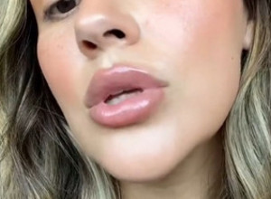 Novi trend "GYM LIPS" koji je osvojio žene širom sveta, a muškarce će potpuno sludeti:  Sočne usne za kojima će se svi okretati (FOTO)