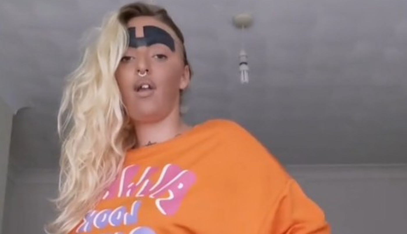 ŽENA S NAJVEĆIM OBRVAMA PREŽIVLJAVA PAKAO! Prete joj oduzimanjem dece i da nikada neće naći partnera, a evo kako izgleda! (FOTO, VIDEO)