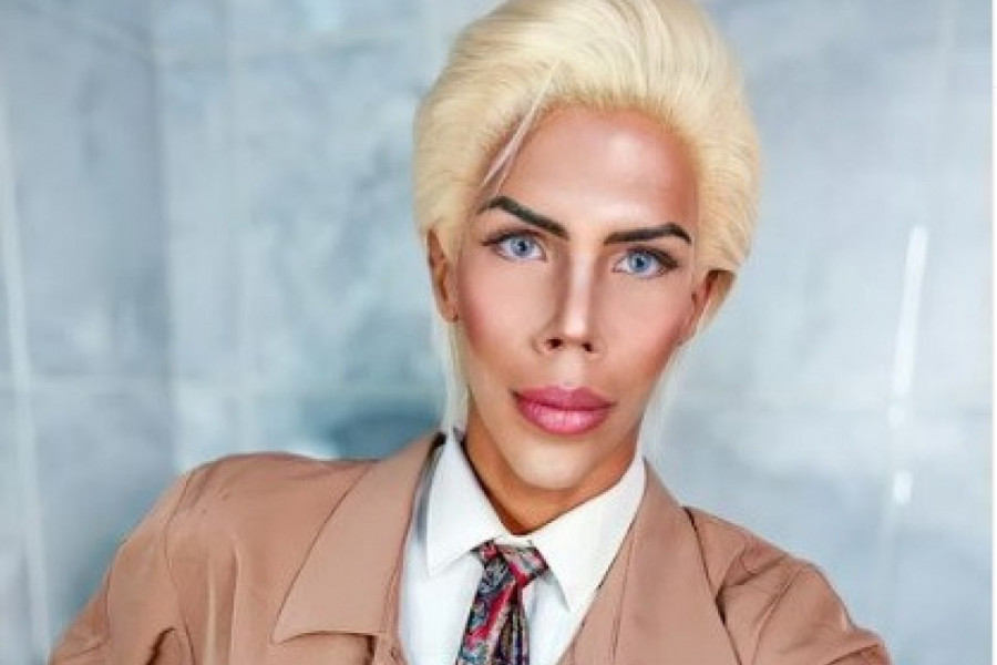 DA LI SE SEĆATE LJUDSKOG KENA? Život mu se promenio iz korena, njegove nove fotografije iznenadile su javnost! (FOTO)