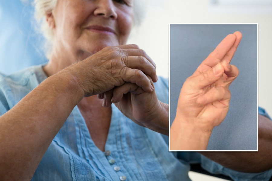 Za samo 7 sekundi saznajte da li patite od Alchajmerove bolesti! Prsti na šakama sve otkrivaju! (VIDEO)