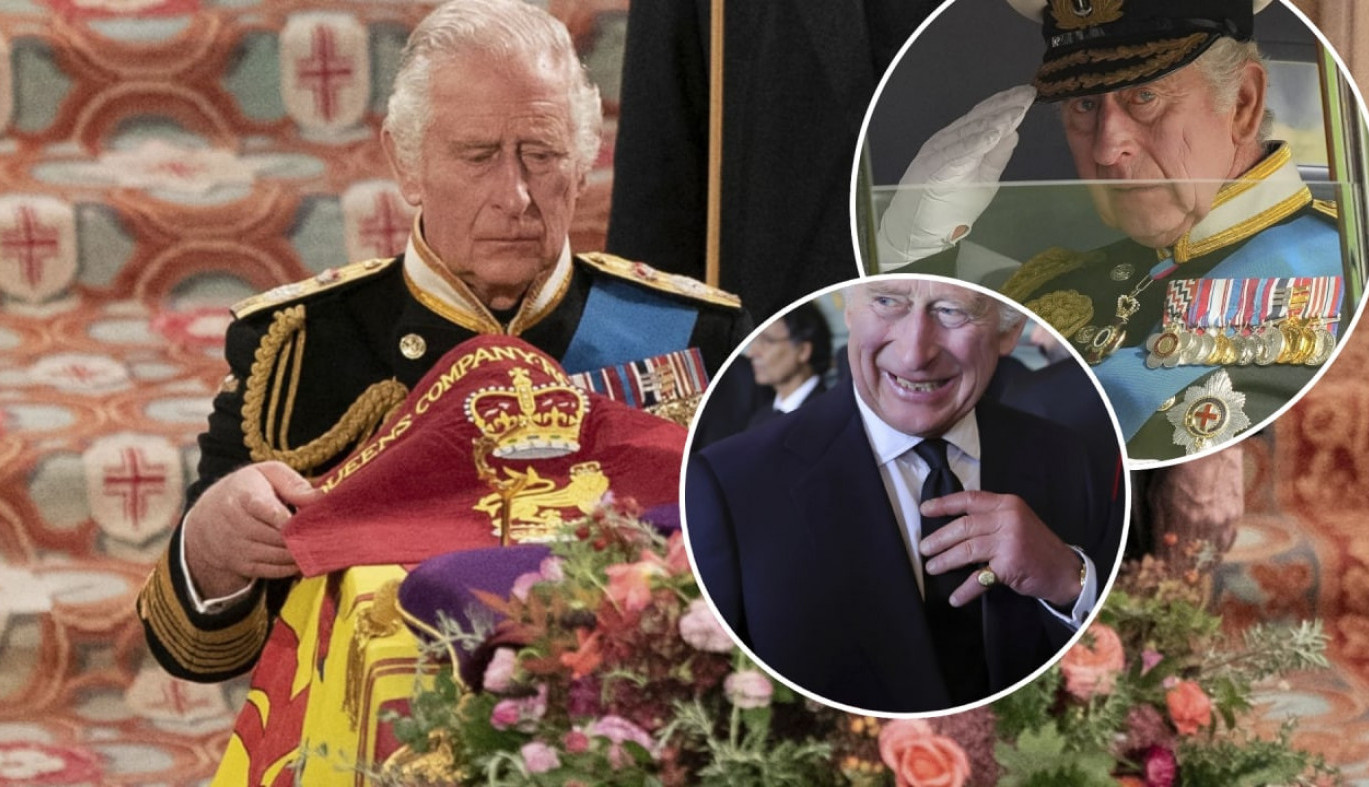 KRALJ ČARLS III TEŠKO BOLESTAN? Novi šok u Britaniji: Šta mu je se dešava sa šakama, jezive fotografije obilaze svet! (FOTO)