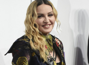 ŠOK MADONIN SNIMAK! Šta joj se desilo?