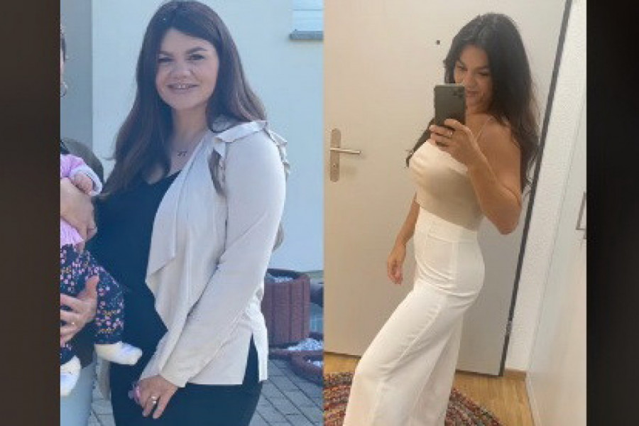BEZ OPERACIJE ŽELUCA SMRŠALA 30 KILOGRAMA ZA 6 MESECI! Transformacija ove devojke je neverovatna, a evo šta je njena tajna!